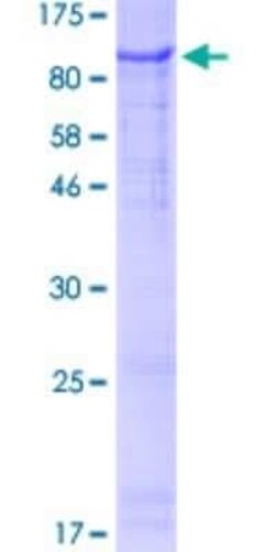 Novus Biologicals Recombinant Human Zinc finger protein 180 GST (N-Term) Protein 10 &mu;g | Buy Online | Novus Biologicals&trade; | Fisher Scientific