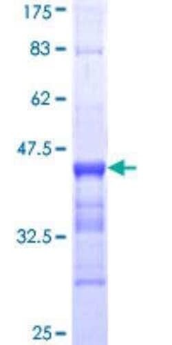 Novus Biologicals Recombinant Human actin, gamma 2 GST (N-Term) Protein 10 &mu;g | Buy Online | Novus Biologicals&trade; | Fisher Scientific