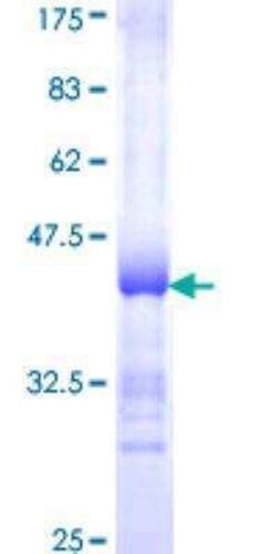 Novus Biologicals Recombinant Human alcohol dehydrogenase 4 GST (N-Term) Protein 10 &mu;g | Buy Online | Novus Biologicals&trade; | Fisher Scientific