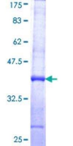 Novus Biologicals Recombinant Human alcohol dehydrogenase 7 GST (N-Term) Protein 25 &mu;g | Buy Online | Novus Biologicals&trade; | Fisher Scientific