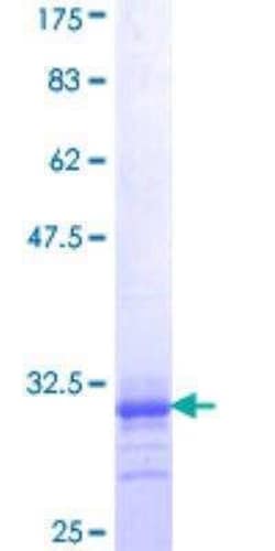 Novus Biologicals Recombinant Human alpha-1A Adrenergic R/ADRA1A GST (N-Term) Protein 10 &mu;g | Buy Online | Novus Biologicals&trade; | Fisher Scientific