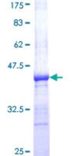 Novus Biologicals Recombinant Human alpha Adaptin GST (N-Term) Protein 25 &mu;g | Buy Online | Novus Biologicals&trade; | Fisher Scientific