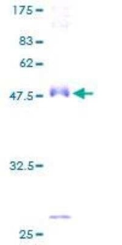 Novus Biologicals Recombinant Human alpha-Methylacyl-CoA Racemase/AMACR GST (N-Term) Protein 2 &mu;g | Buy Online | Novus Biologicals&trade; | Fisher Scientific