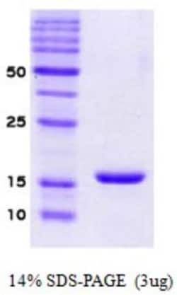 Novus Biologicals&trade;&nbsp;Recombinant Human alpha-Synuclein Protein