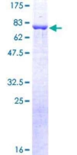 Novus Biologicals Recombinant Human beta-Arrestin 2 GST (N-Term) Protein 10 &mu;g | Buy Online | Novus Biologicals&trade; | Fisher Scientific