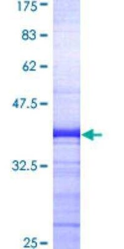 Novus Biologicals Recombinant Human beta-Arrestin 2 GST (N-Term) Protein 25 &mu;g | Buy Online | Novus Biologicals&trade; | Fisher Scientific