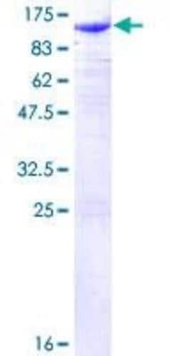 Novus Biologicals Recombinant Human beta-Catenin GST (N-Term) Protein 25 &mu;g | Buy Online | Novus Biologicals&trade; | Fisher Scientific