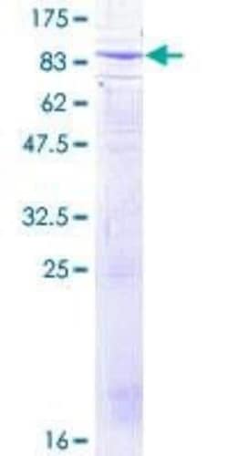 Novus Biologicals Recombinant Human beta-TrCP1/BTRC GST (N-Term) Protein 10 &mu;g | Buy Online | Novus Biologicals&trade; | Fisher Scientific