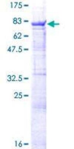 Novus Biologicals Recombinant Human csl/RBPJK GST (N-Term) Protein 2 &mu;g | Buy Online | Novus Biologicals&trade; | Fisher Scientific