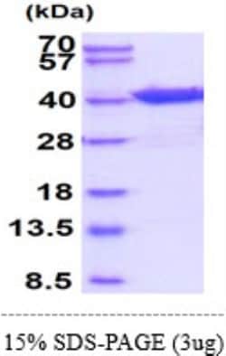 Novus Biologicals&trade;&nbsp;Recombinant Human eIF2 alpha/EIF2S1 His Protein