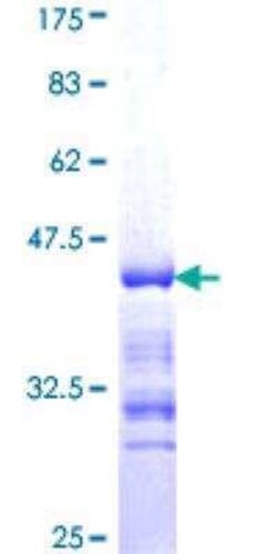 Novus Biologicals Recombinant Human gamma Adducin GST (N-Term) Protein 25 &mu;g | Buy Online | Novus Biologicals&trade; | Fisher Scientific