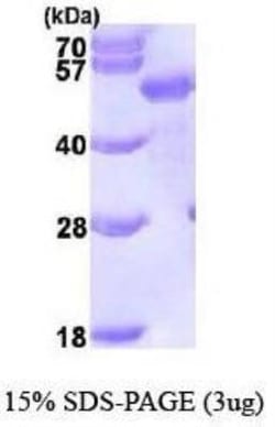 Novus Biologicals Recombinant Human p62/SQSTM1 His Protein 0.1 mg | Buy Online | Novus Biologicals&trade; | Fisher Scientific