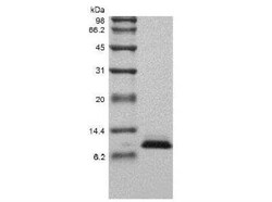 Novus Biologicals Recombinant Human NT-proBNP Protein 100 &mu;g | Buy Online | Novus Biologicals&trade; | Fisher Scientific