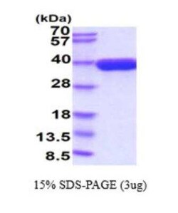 Novus Biologicals Recombinant Mouse EGF-L6 His Protein 50 &mu;g | Buy Online | Novus Biologicals&trade; | Fisher Scientific