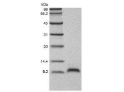Novus Biologicals Recombinant Mouse EGF Protein 1mg | Buy Online | Novus Biologicals&trade; | Fisher Scientific