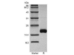 Novus Biologicals Recombinant Mouse GDF-7/BMP-12 Protein 500 &mu;g | Buy Online | Novus Biologicals&trade; | Fisher Scientific