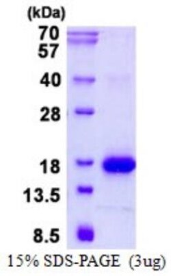 Novus Biologicals&trade;&nbsp;Recombinant Mouse Galectin-1 His Protein