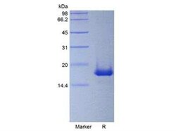 Novus Biologicals Recombinant Mouse IL-19 Protein 10 &mu;g | Buy Online | Novus Biologicals&trade; | Fisher Scientific