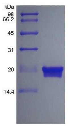 Novus Biologicals Recombinant Mouse IL-28B/IFN-lambda 3 Protein 1 mg | Buy Online | Novus Biologicals&trade; | Fisher Scientific
