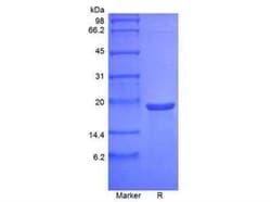 Novus Biologicals Recombinant Mouse MANF Protein 1000 &mu;g | Buy Online | Novus Biologicals&trade; | Fisher Scientific