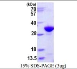 Novus Biologicals Recombinant Mouse IgG Protein 0.5 mg | Buy Online | Novus Biologicals&trade; | Fisher Scientific