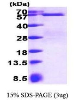Novus Biologicals&trade;&nbsp;Recombinant Human Smad3 His Protein