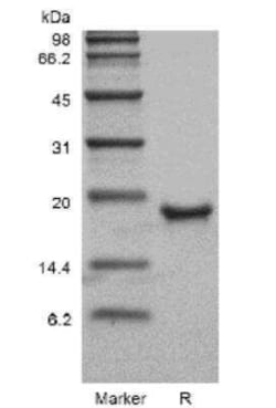 Novus Biologicals Recombinant Mouse Thrombopoietin/THPO Protein 500 &mu;g | Buy Online | Novus Biologicals&trade; | Fisher Scientific