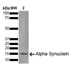 Novus Biologicals Recombinant Mouse alpha-Synuclein (Control) Protein, Pre-formed Fibrils 100 &mu;g | Buy Online | Novus Biologicals&trade; | Fisher Scientific