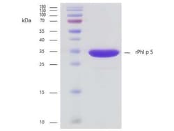 Novus Biologicals Recombinant Plant Phleum pratense 5.0101 Strep (N-Term) Protein 0.1 mg | Buy Online | Novus Biologicals&trade; | Fisher Scientific