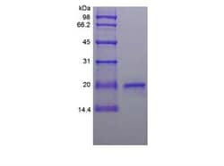 Novus Biologicals™ Recombinant Sheep IFN-tau-1 Protein