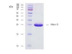 Novus Biologicals&trade;&nbsp;Recombinant Vespula vulgaris 5.0101 Strep (N-Term) Protein