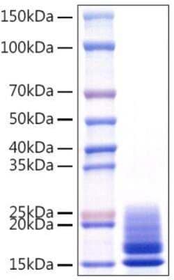Novus Biologicals Recombinant Viral Monkeypox Virus A29L (HEK-293-expressed) His (C-Term) Protein 100 &mu;g | Buy Online | Novus Biologicals&trade; | Fisher Scientific