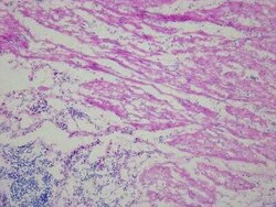 Novus Biologicals Rectum Matched Tumor and Normal Tissue Slides (Tumor)- Frozen 10 Slides | Buy Online | Novus Biologicals&trade; | Fisher Scientific