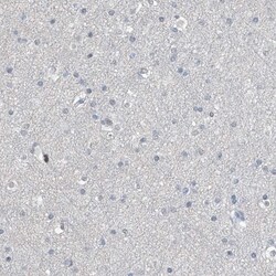Regucalcin Antibody, Novus Biologicals:Antibodies:Primary Antibodies