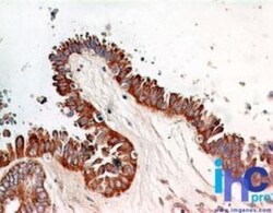 RelA/NFkB p65 Antibody (112A1021) - BSA Free, Novus Biologicals 0.1mg;