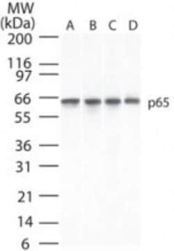 RelA/NFkB p65 Antibody (112A1021) - BSA Free, Novus Biologicals 0.1mg;