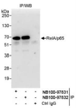 RelA/NFkB p65 Antibody, Novus Biologicals 100 &mu;L | Buy Online | Novus Biologicals | Fisher Scientific