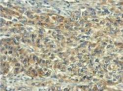 RelB Antibody, Novus Biologicals 0.1mL; Unlabeled:Antibodies, Polyclonal