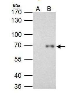 RelB Antibody, Novus Biologicals 0.1mL; Unlabeled:Antibodies, Polyclonal