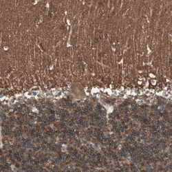 Renin R Antibody, Novus Biologicals 0.1mL; Unlabeled:Antibodies, Polyclonal