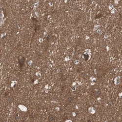 Renin R Antibody, Novus Biologicals 0.1mL; Unlabeled:Antibodies, Polyclonal