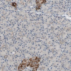 Renin R Antibody, Novus Biologicals 0.1mL; Unlabeled:Antibodies, Polyclonal