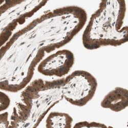 Renin R Antibody, Novus Biologicals 0.1mL; Unlabeled:Antibodies, Polyclonal