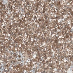 Renin R Antibody, Novus Biologicals 0.1mL; Unlabeled:Antibodies, Polyclonal