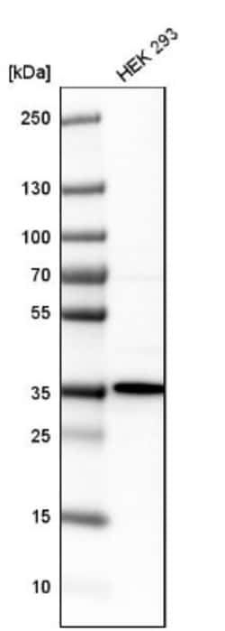 Renin R Antibody, Novus Biologicals 0.1mL; Unlabeled:Antibodies, Polyclonal
