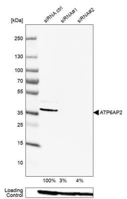 Renin R Antibody, Novus Biologicals 0.1mL; Unlabeled:Antibodies, Polyclonal