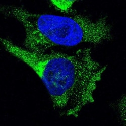 Ret Antibody, Novus Biologicals:Antibodies:Primary Antibodies