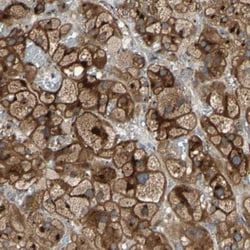 Ret Antibody, Novus Biologicals:Antibodies:Primary Antibodies