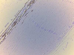 Novus Biologicals Retina Tissue Slides (Adult Normal)- Paraffin 5 Objektträger | Buy Online | Novus Biologicals&trade; | Fisher Scientific