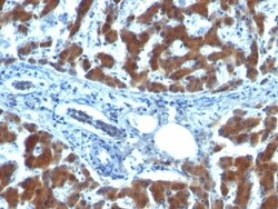 Retinol Binding Protein RBP Antibody (RBP/872), Novus Biologicals 0.2mg;